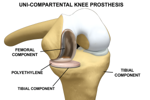 Knee