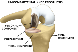 Knee
